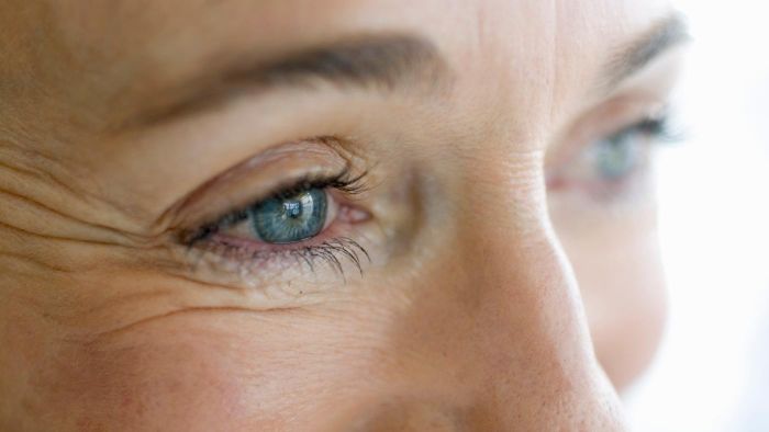 15 moduri de a scăpa de ridurile laba gâștei și de ridurile din jurul ochilor